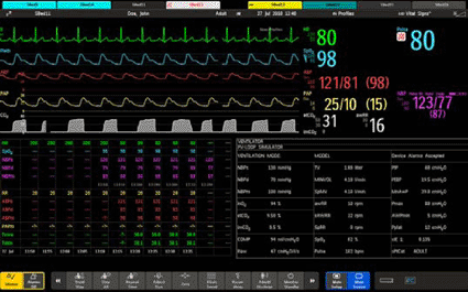 Image: Screenshot of the IntelliVue MX800 patient monitoring system (photo courtesy Philips Healthcare).